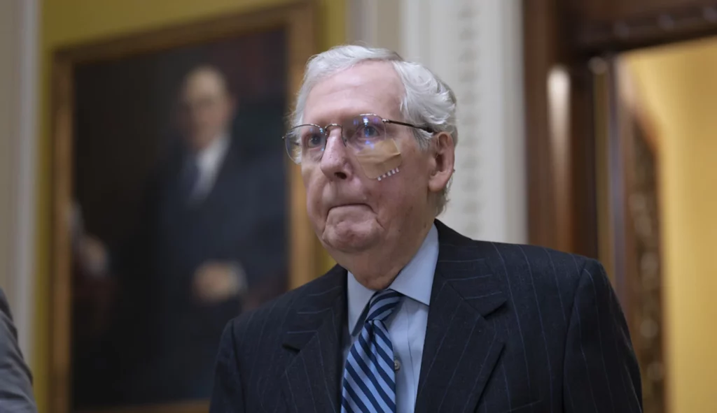 Senate Minority Leader Mitch McConnell (R-KY) is seen with a bandaged face and wrist brace following a stumble and fall earlier at lunch at the Capitol in Washington, Tuesday, Dec. 10, 2024.