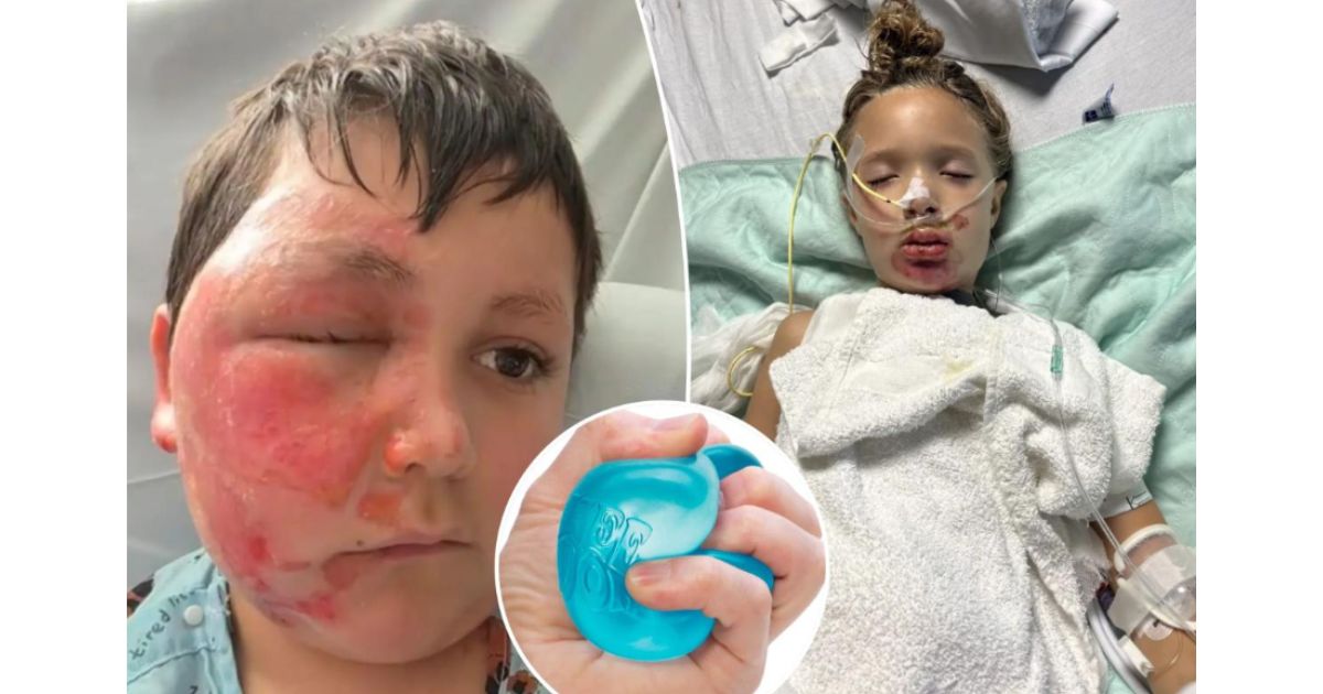 Doctors Issue Warnings as Popular Toy Inflicts Horrific Injuries on Kids